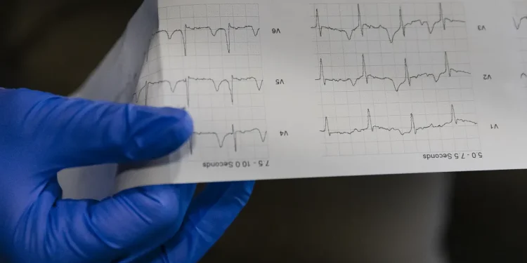 This metric is a better predictor of heart failure than high BMI, new study finds