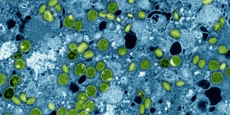Connecticut DPH identifies first case of clade I mpox
