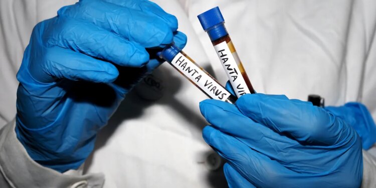 No known cases of hantavirus in U.S. as officials monitor 41 with possible exposure