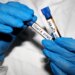 No known cases of hantavirus in U.S. as officials monitor 41 with possible exposure
