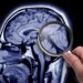 INTERVIEW: Yale neurologist talks link between menopause, Alzheimer's disease