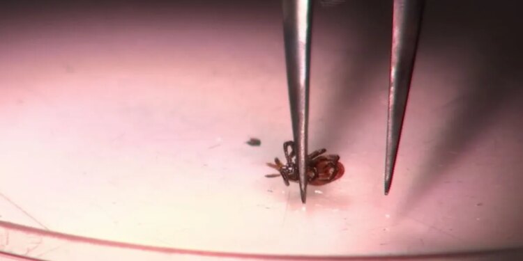 Doctors warn about ticks ahead of peak season in Connecticut