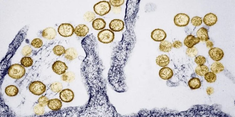 What Connecticut health experts want you to know as hantavirus cases rise