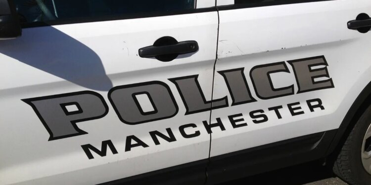 Man hospitalized after being hit by a car in Manchester