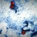 86 people have been hospitalized with foodborne parasite spreading across the U.S., CDC says