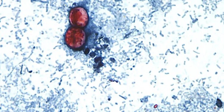 Another cyclospora outbreak not linked to lettuce under investigation: FDA
