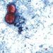 Map: Where cases of 'explosive' diarrhea-causing parasitic illness have been reported