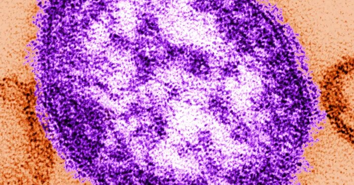 Connecticut reports third measles case of 2026