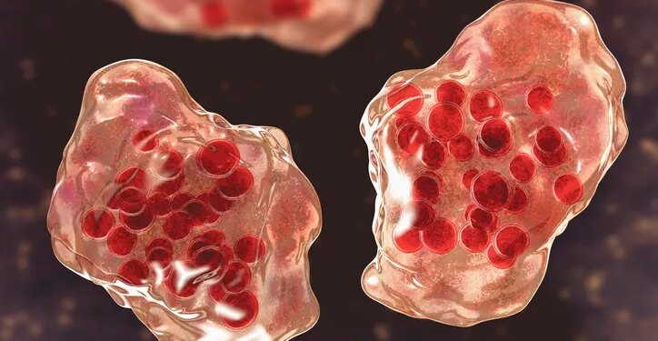 Third measles case of 2026 reported in Connecticut